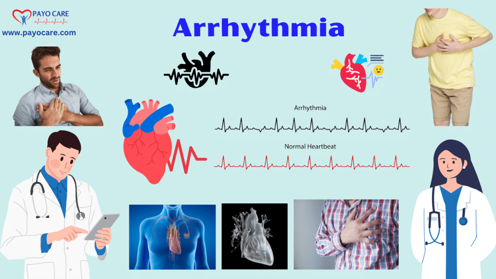 Arrhythmia: Types, Causes, Symptoms, Prevention, Diagnosis & Treatment