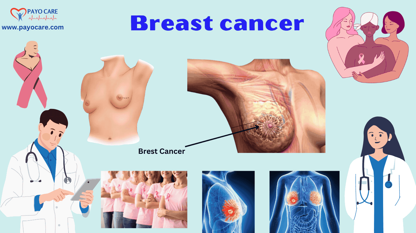 Breast Cancer: Causes, Symptoms & Treatment