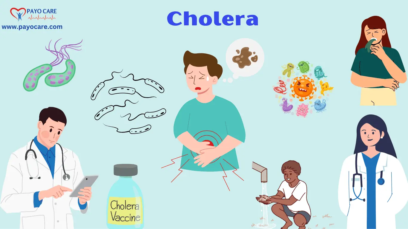 Cholera: Causes, Symptoms and Treatments