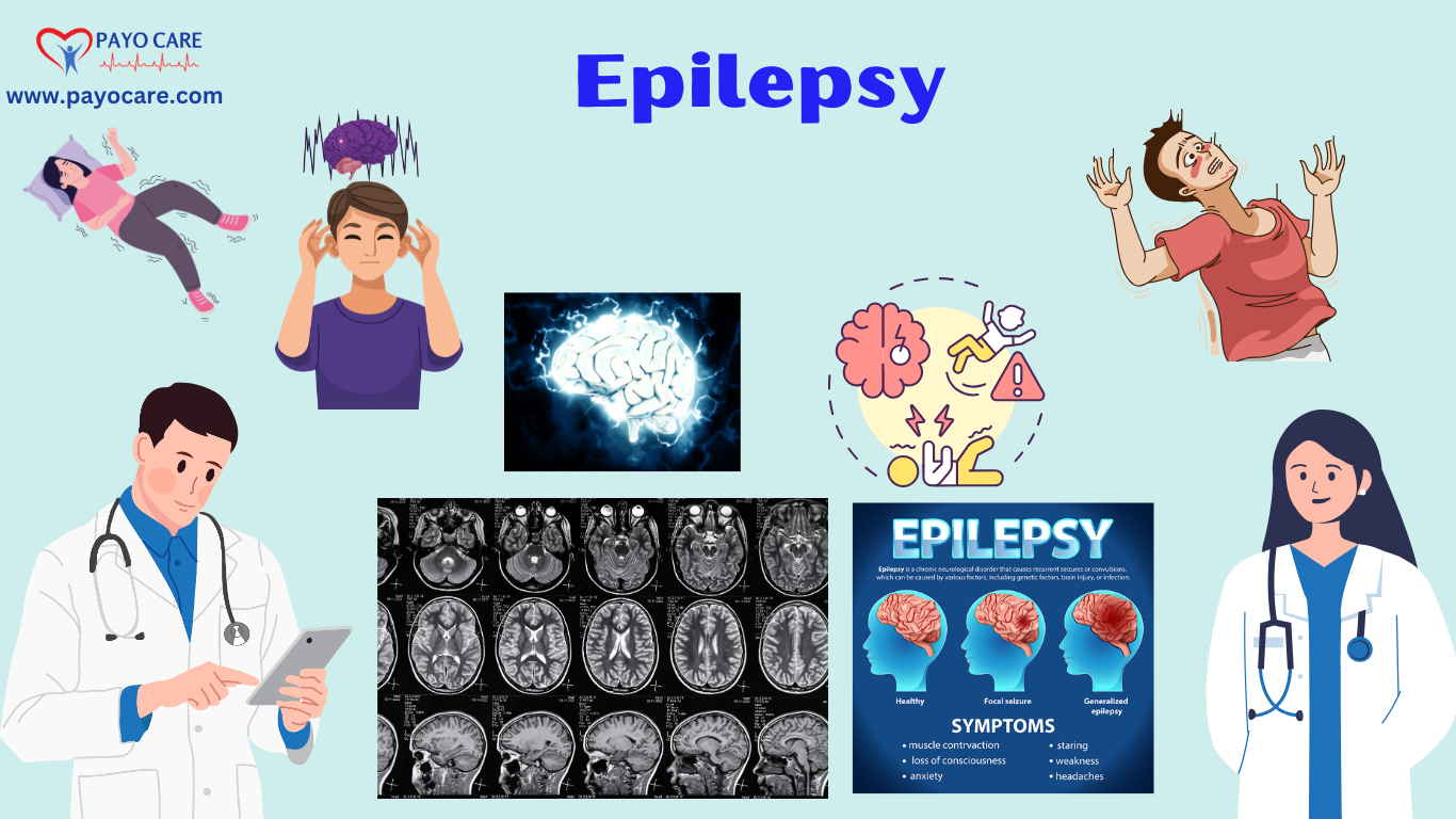 Epilepsy:Causes, Symptoms & Treatments