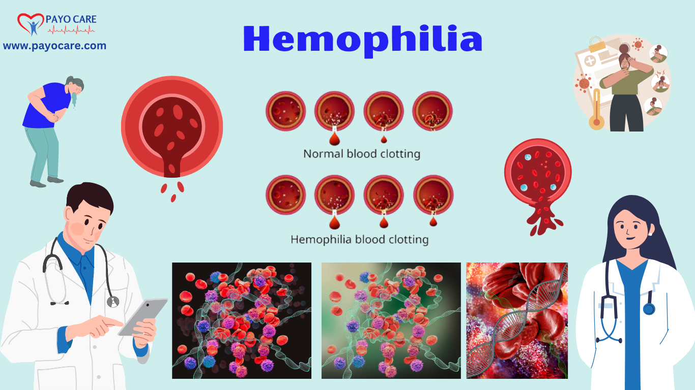 Hemophilia: Causes, Symptoms, Prevention & Treatment