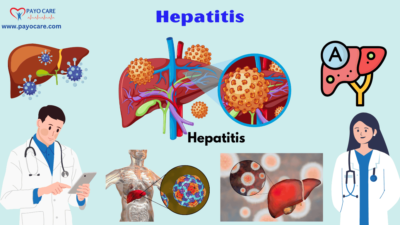 Hepatitis :Causes, Symptoms,Prevention & Treatment