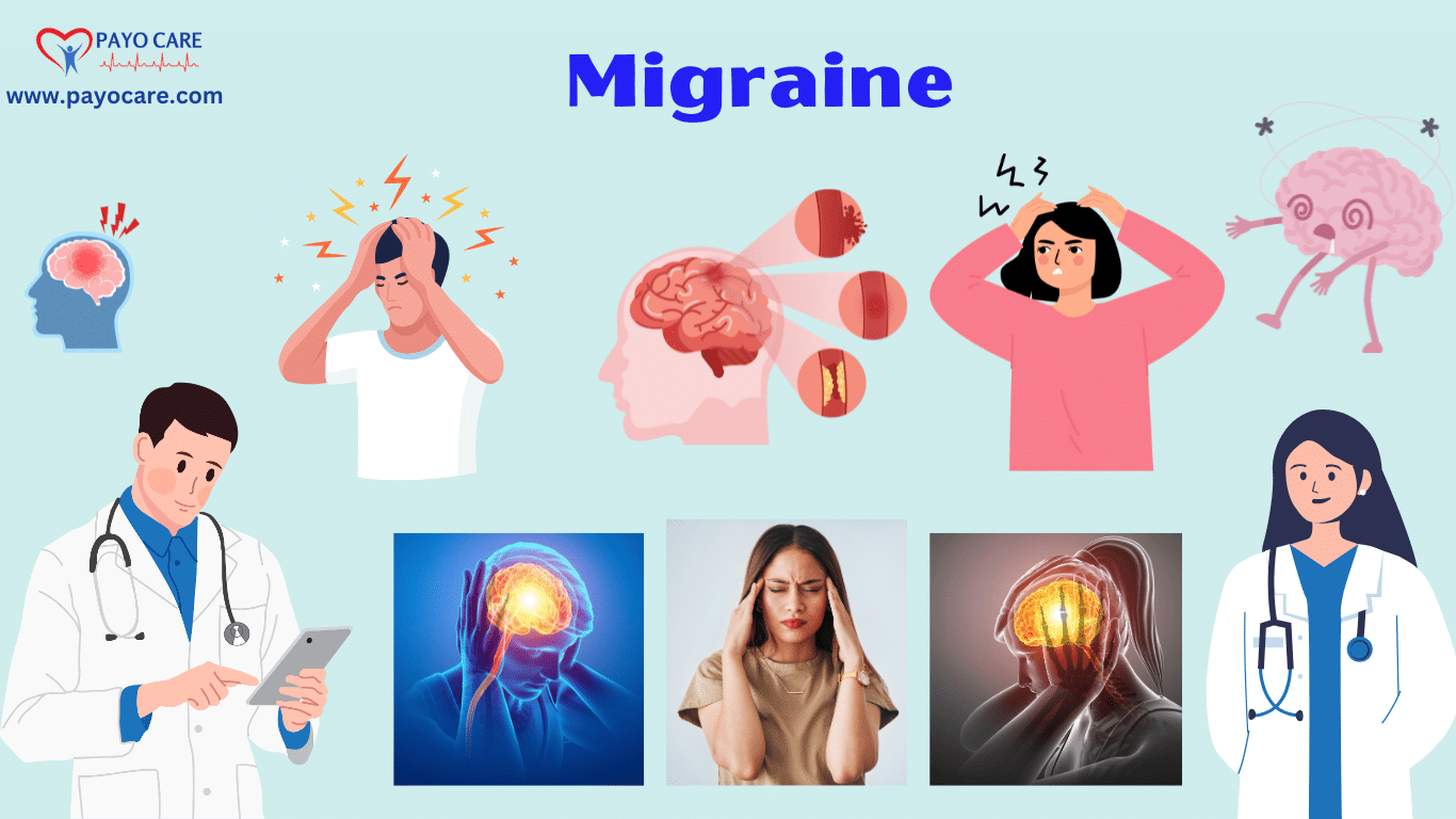 Migraines: Causes, Symptoms &Treatment
