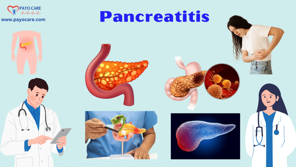 Pancreatitis:Types, Causes, Symptoms, Prevention, Diagnosis & Treatment