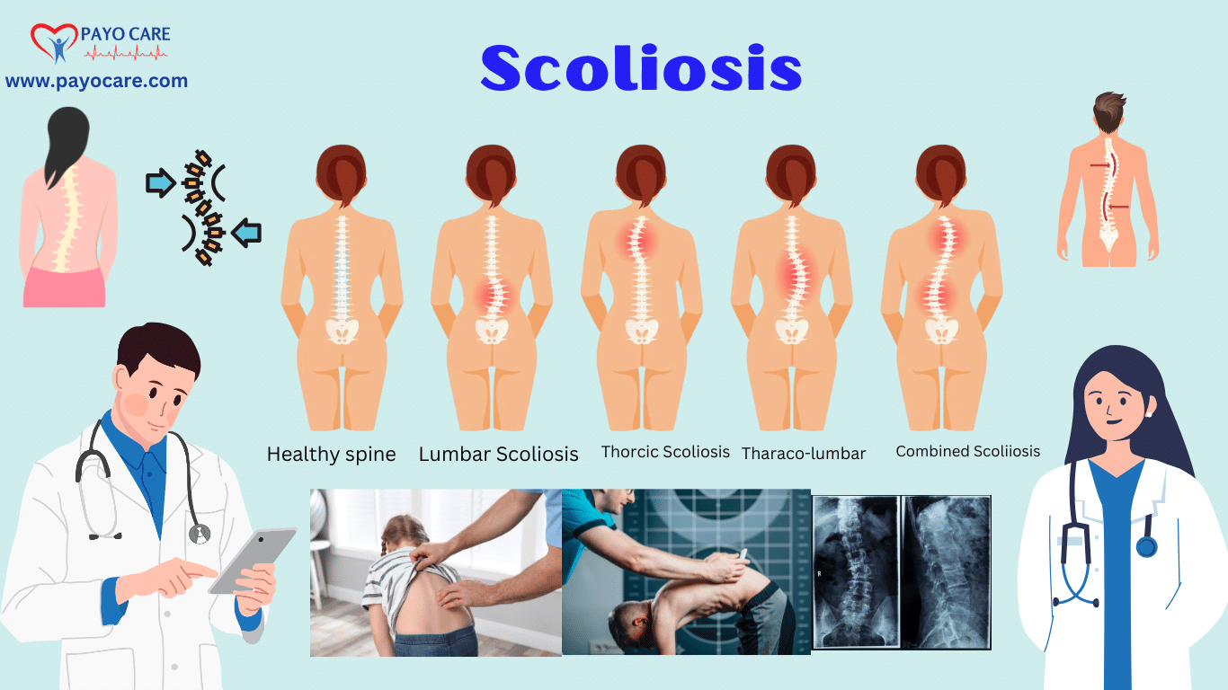 Scoliosis: Types, Causes, Symptoms, Prevention, Diagnosis & Treatment