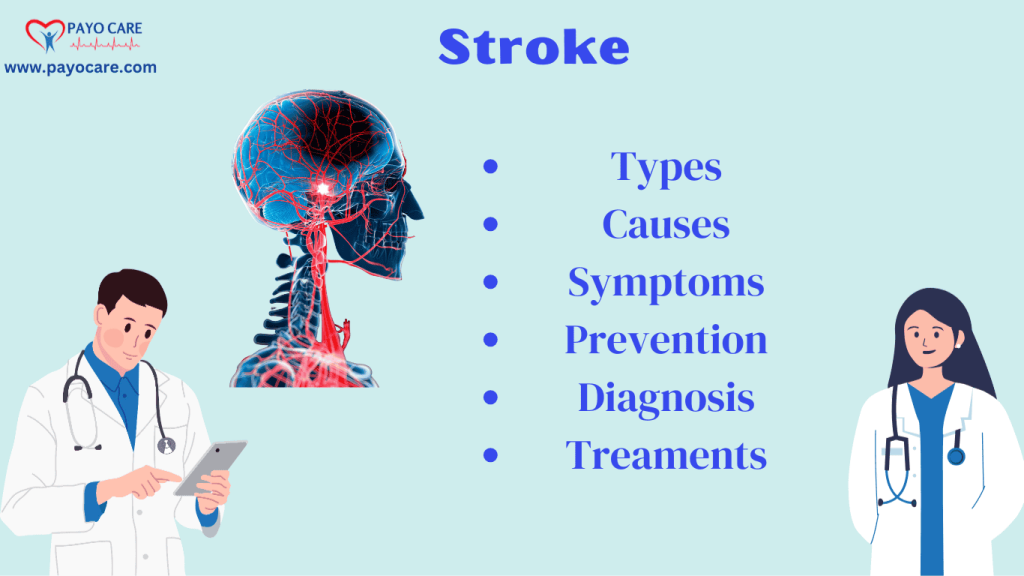 Stroke: Types, Causes, Symptoms, Prevention, Diagnosis, and Treatments