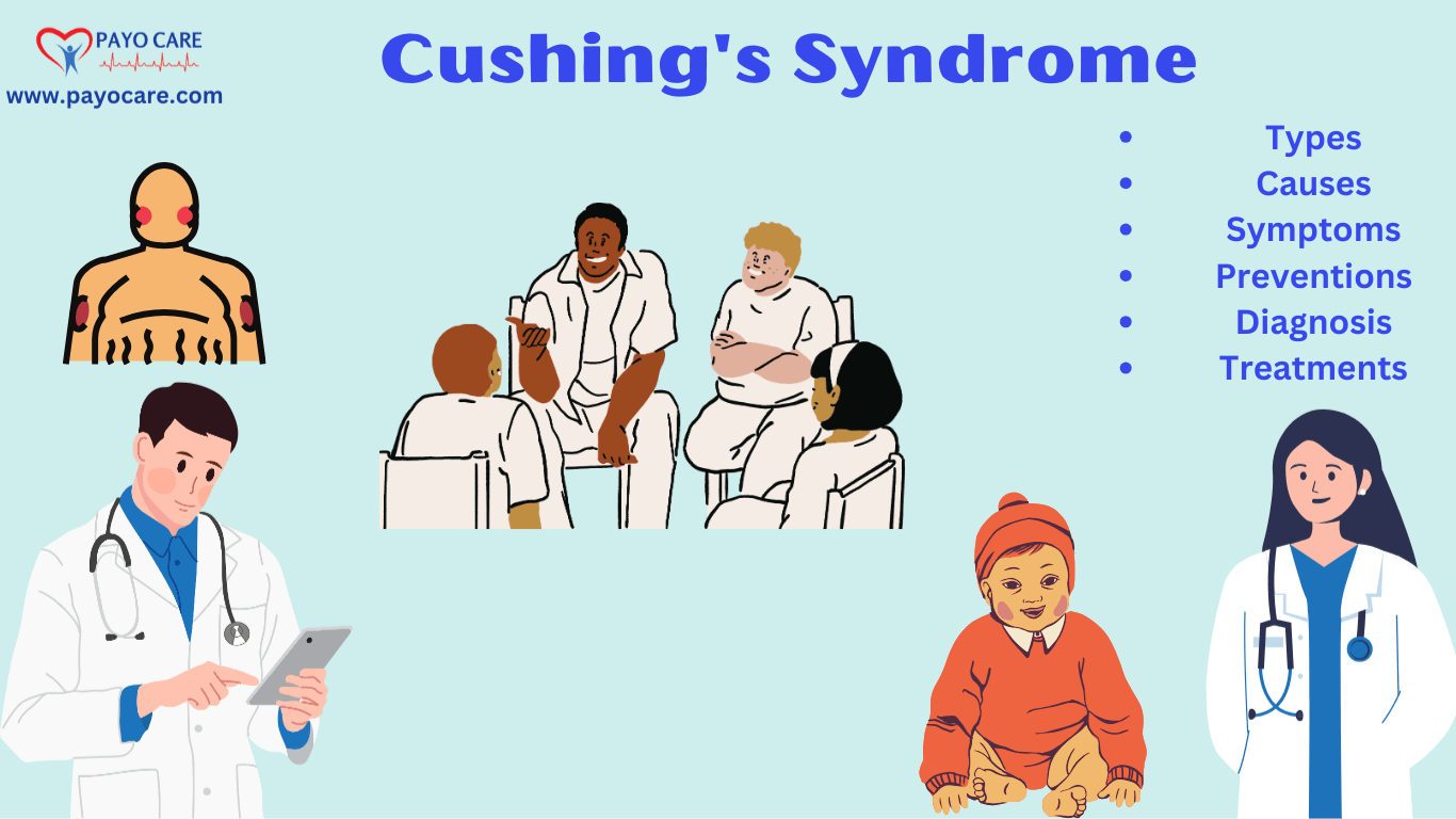 Cushing’s Syndrome: Causes, Symptoms and Treatments