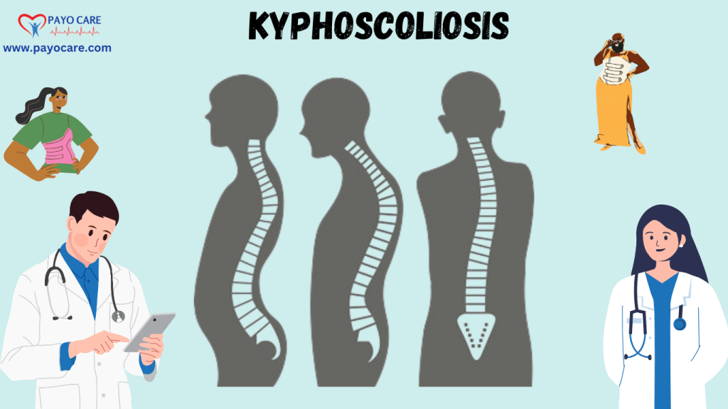 Kyphoscoliosis: Causes, Symptoms, Prevention, Diagnosis, and Treatment