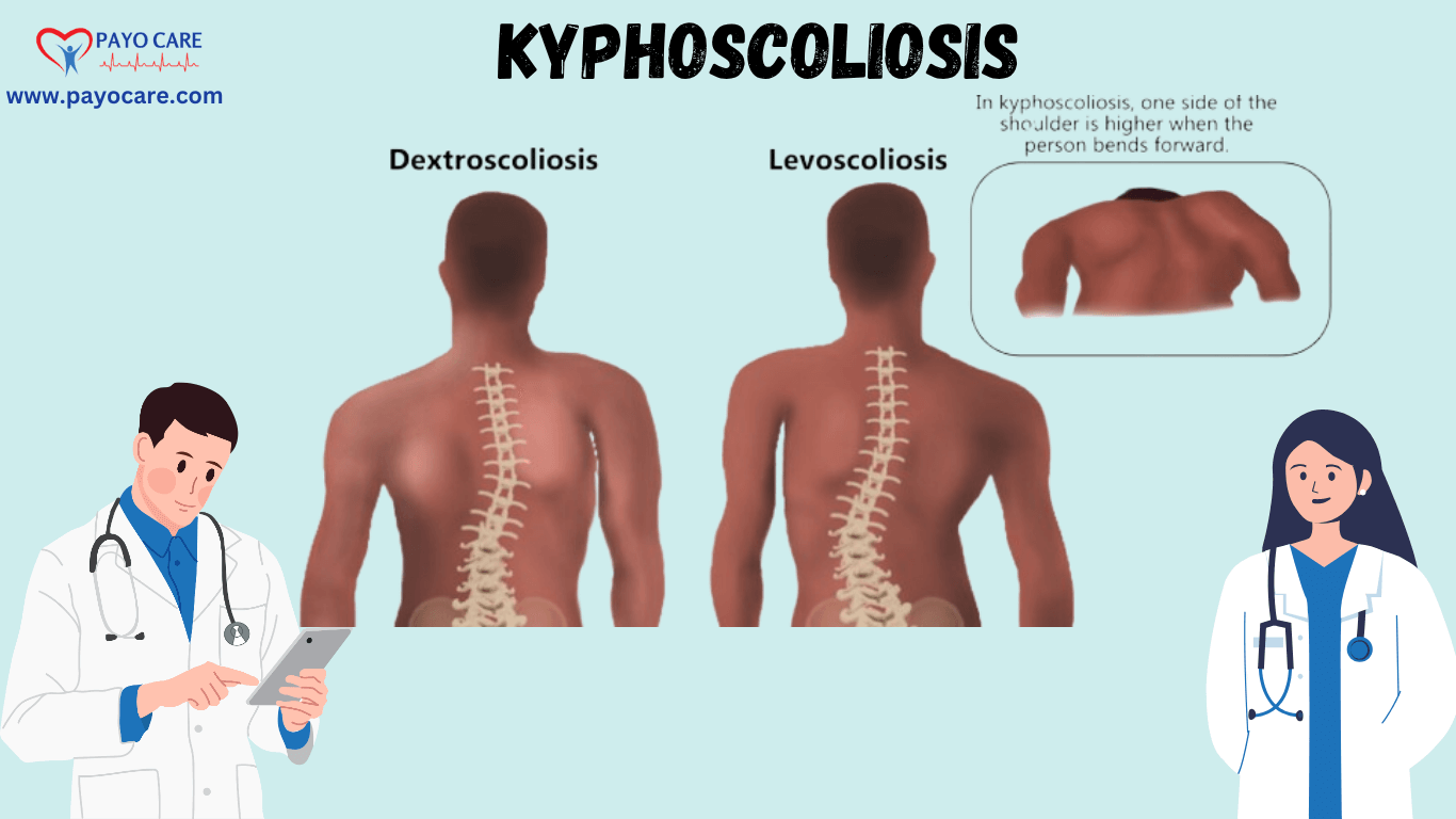 Kyphoscoliosis: Causes, Symptoms, Prevention, Diagnosis, and Treatment