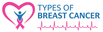 Types of Breast Cancer | Symptoms, Stages & Treatment Options